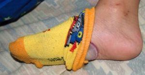 पैरों पर प्याज रखकर सोने के चार फायदे