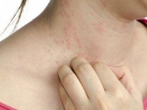 डायबिटीज के 5 कम ज्ञात लक्षण