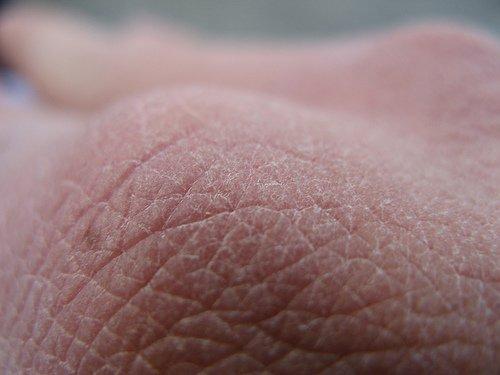 डायबिटीज के लक्षण