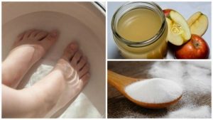 नाखूनों के फंगस का सफाया किचेन की इन दो सामग्रियों से