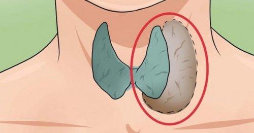 थाइराइड की समस्या: 14 संकेत और लक्षण