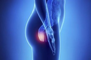 गुदा के कैंसर के 5 लक्षणों के बारे में जानें