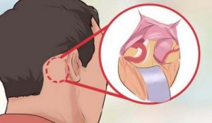 ट्राईजेमिनल न्युरॉल्जिया, दुनिया के सबसे खराब दर्द के बारे में 5 बातें