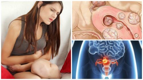 गर्भाशय के फाइब्रॉइड से जुड़े 5 तथ्य: हर महिला को इन्हें जानना जरूरी है