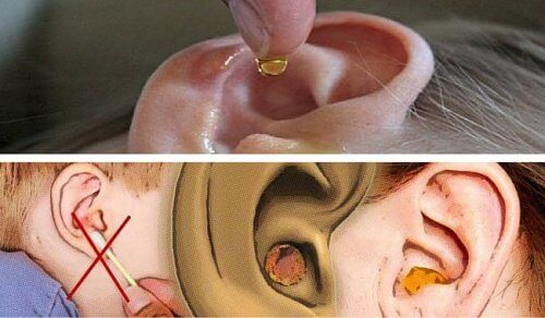 कान की मैल साफ़ करने के नेचुरल तरीके