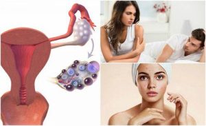 पॉलीसिस्टिक ओवेरियन सिंड्रोम के 7 लक्षण: इन्हें नज़रंदाज़ न करें