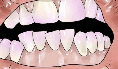 दाँतों के टार्टर से छुटकारा पाने के प्राकृतिक तरीके