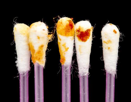 कानों की सफ़ाई: ईयर वैक्स