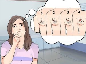 अलग-अलग किस्म के ब्रैस्ट कैंसर, उनके लक्षण और इलाज