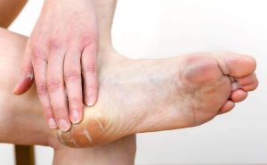 ऊंची हील्स: फटी एड़ियाँ