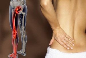 6 आसान एक्सरसाइज साइटिका के दर्द से निजात पाने के लिए