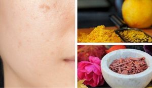 त्वचा के गहरे दाग-धब्बों से छुटकारा कैसे पाएं