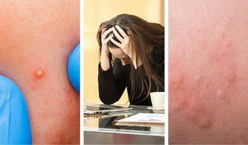 7 चीज़ें जो बताती हैं कि आप बहुत तनाव में हैं