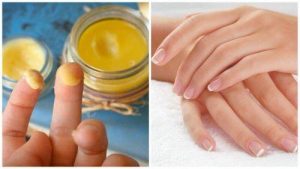 100% नेचुरल ट्रीटमेंट से दोबारा हाथों को खूबसूरत बनायें