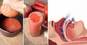 खर्राटे और स्लीप एपनिया को बंद करने के प्राकृतिक नुस्खे