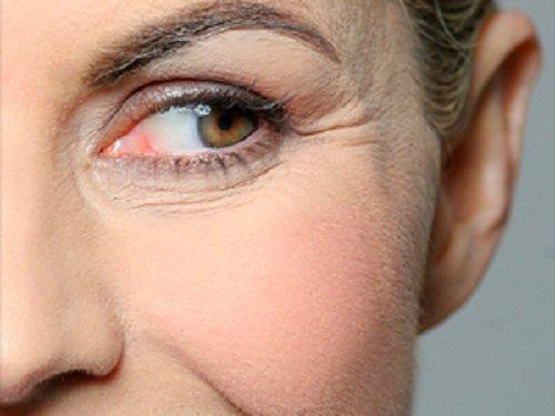 एप्पल साइडर विनेगर से आप अपने चेहरे की झुर्रियों से छुटकारा पा सकते हैं