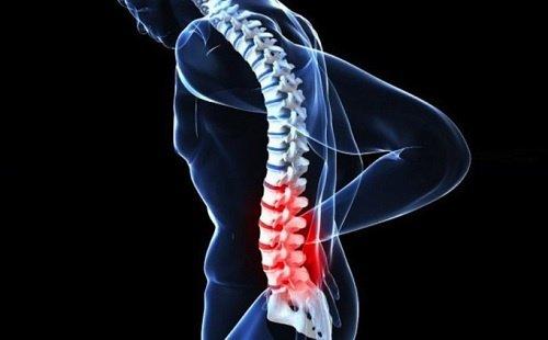 रीढ़ की हड्डी वाला दुर्लभ कैंसर