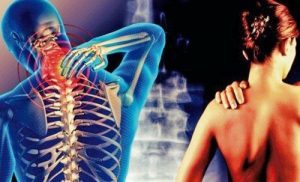 सर्विकोब्रैकियल सिंड्रोम: दर्द आपकी गर्दन से होकर बाजुओं तक जाता है