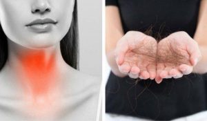 8 चीजें जो आप थायरॉइड की वजह से बालों का झड़ना रोकने के लिए कर सकते हैं