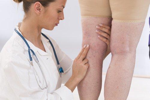 हाइड्रेशन और एडीमा (Hydration and edema)