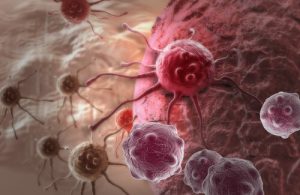ट्यूमर्स में ऐवोकैडो सीड्स के फायदे