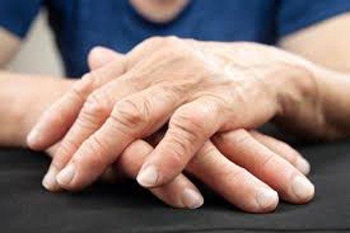 आर्थराइटिस का इलाज करने का नया तरीका