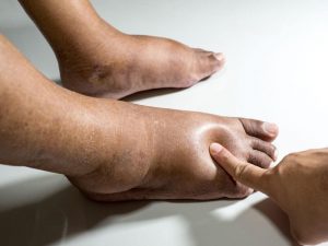 किडनी डिटॉक्स डाइट: किडनी का काम