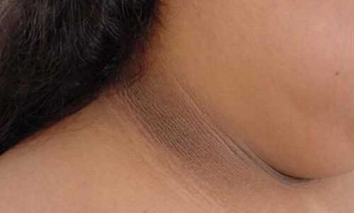 अपनी गर्दन की त्वचा के गहरे रंग को हल्का करने के 4 तरीके