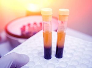 क्या आपको अपना प्लेटलेट काउंट बढ़ाने की जरूरत है? ये 4 नुस्खे आजमाइए