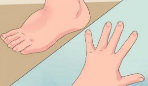 5 आसान उपाय वॉटर रिटेंशन को कम करने के लिये