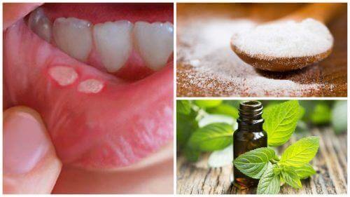 7 प्राकृतिक नुस्खे: मुंह के छालों के उपचार के लिये