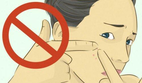 अपने पिम्पल्स को फोड़ने से परहेज़ करें