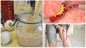 इस अद्भुत नेचुरल सिरप से कोलेस्ट्रॉल और जोड़ों का दर्द कम करें