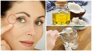 इस नेचुरल नाइट क्रीम से आँखों की बाहरी कोर वाली झुर्रियां (क्रो'ज फूट) घटाएं