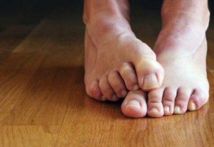 पैरों की उँगलियों में लगी फंगस के बारे में 7 तथ्य