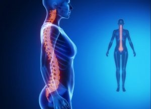 पीठ के निचले हिस्से में दर्द : जोड़ों के डिजेनेरेटिव रोग (Degenerative joint diseases)