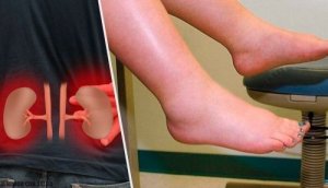 शरीर में क्यों रुकने लगता है अतिरिक्त पानी?