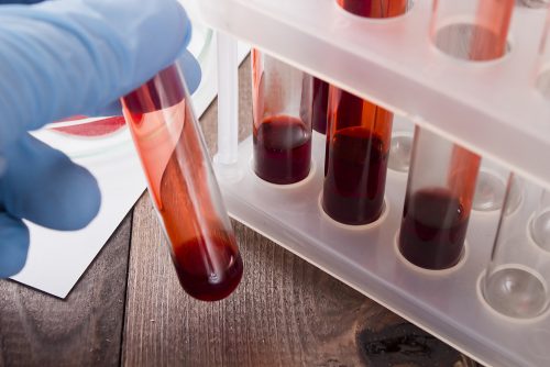 अच्छी खबर : खून की जांच से अब शुरू में ही कैंसर का पता लगाया जा सकेगा