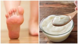 पैरों के कैलस कैसे निकालें: DIY दही और विनेगर की रेसिपी