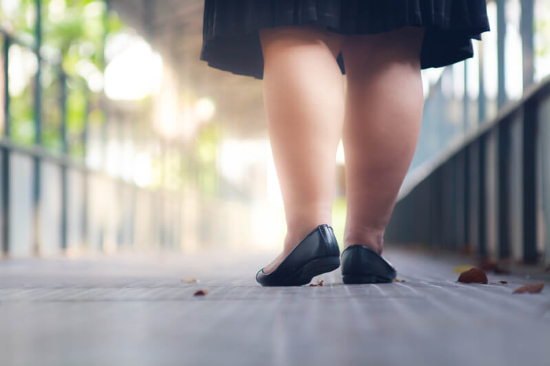 लिपेडेमा के लक्षण