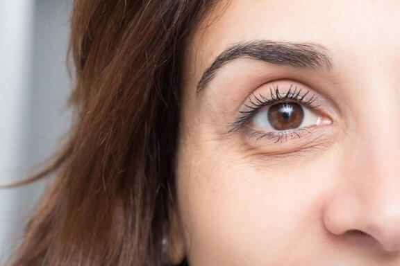 आंखों की सूजन और काले घेरों को रोकने के लिए दस शानदार टिप्स