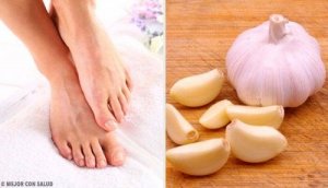 लहसुन से करें अन्दर की तरफ बढ़े पैर के नाखून में संक्रमण का इलाज