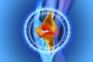 मेनिस्कस ऑपरेशन के बाद घुटने का पुनर्वास