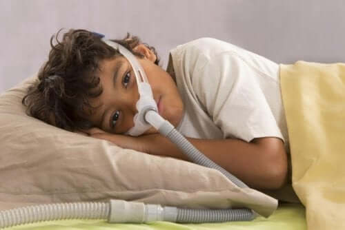 बच्चों में ऑब्सट्रक्टिव स्लीप एपनिया