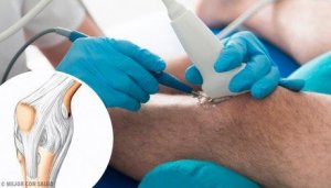 घुटने की आर्थोस्कोपी के लाभ