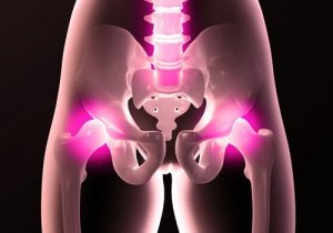 कूल्हे की समस्याएं