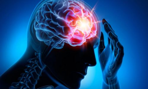 4 सबसे आम सेरिब्रोवैस्कुलर रोग