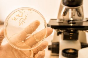 सतही कैंडिडिऑसिस