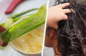 गंजेपन का इलाज : एलोवेरा (Aloe vera)