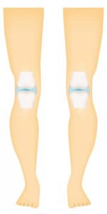 सिनोवियल जॉइंट्स की किस्में